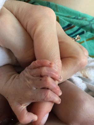 fingers2